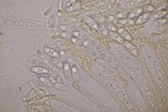 Octospora musci-muralis