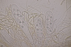 Octospora musci-muralis