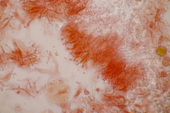 Zyzygomyces physciacearum