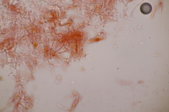 Zyzygomyces physciacearum