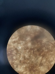 Botryobasidium simile