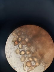 Botryobasidium simile