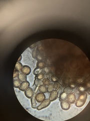 Botryobasidium simile