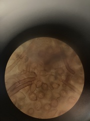 Botryobasidium simile