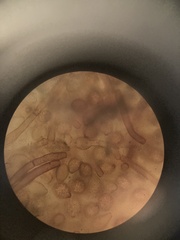 Botryobasidium simile
