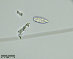 Odontochlamys gouraudi