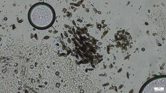 Xylaria apiculata