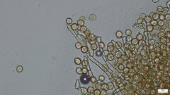 Botryobasidium