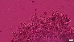 Phlebia