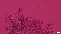 Phlebia