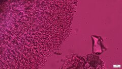 Phlebia