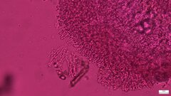 Phlebia