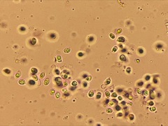 Hohenbuehelia auriscalpium