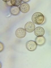 Physarum polycephalum