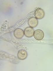 Physarum polycephalum