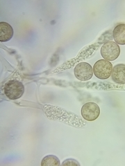 Physarum polycephalum