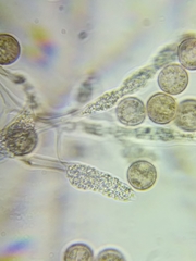 Physarum polycephalum