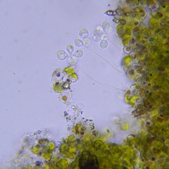 Choanoflagellatea