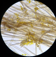 Oscillatoria nigro-viridis