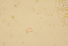 Dacrymyces capitatus