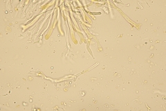 Dacrymyces capitatus