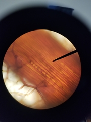 Rhizomnium punctatum