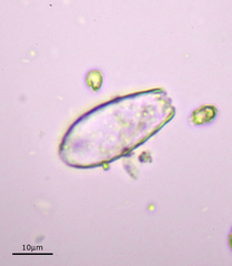 Euglypha laevis