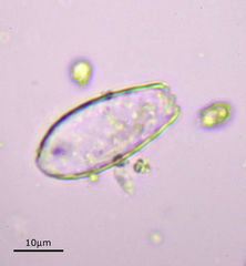 Euglypha laevis