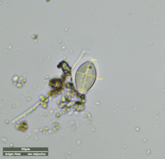 Sessilida