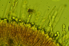 Chaetotyphula actiniceps