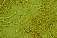 Chaetotyphula actiniceps