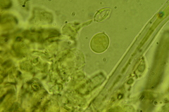 Chaetotyphula actiniceps