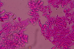 Porotheleaceae