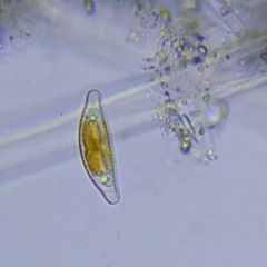 Cymbella
