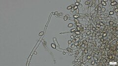 Botryobasidium