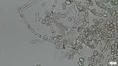 Botryobasidium