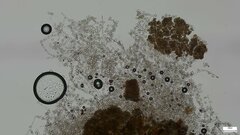 Botryobasidium
