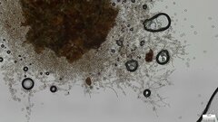 Botryobasidium