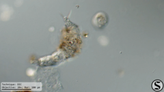 Dissotrocha macrostyla