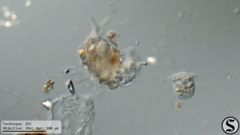 Dissotrocha macrostyla