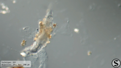 Dissotrocha macrostyla