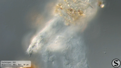 Dissotrocha macrostyla