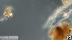 Dissotrocha macrostyla