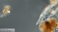 Dissotrocha macrostyla