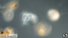 Vorticella