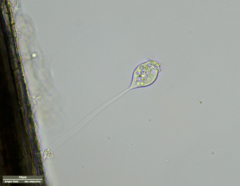 Vorticella