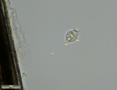 Vorticella