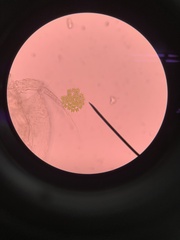 Hydrodictyaceae
