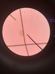 Hydrodictyaceae