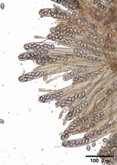 Octospora gyalectoides